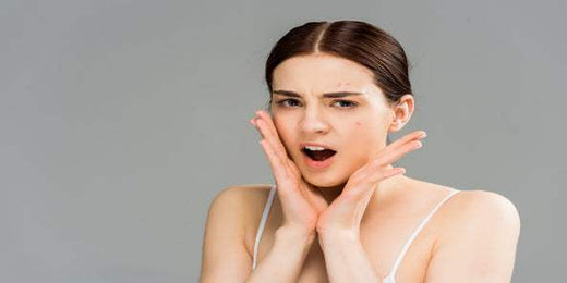 Kolajen Takviyesi Sivilce Yapar mı? İşte Bilmeniz Gerekenler - Supra Protein